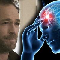 luke-perry-meninggal-karena-stroke-waspadai-10-tanda-awal-stroke-di-usia-muda
