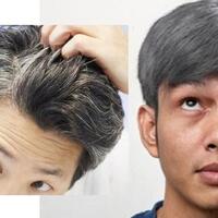 masih-muda-sudah-ubanan-bisa-jadi-karena-kurang-gizi