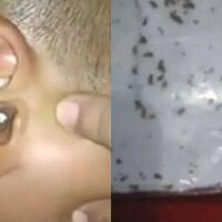 diduga-telinganya-kemasukan-ribuan-semut-bocah-di-majalengka-menangis-meraung-raung