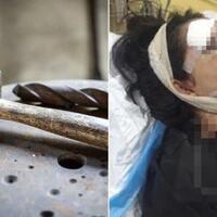 ayah-pukul-wajah-anaknya-dengan-palu-karena-tak-dapat-pekerjaan-setelah-lulus-kuliah