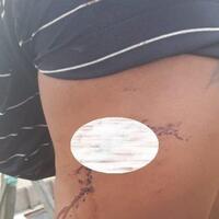 lindungi-sang-ibu-seorang-pemuda-di-banjarmasin-jadi-korban-pembacokan-pamannya