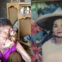 pencet-jerawat-enam-tahun-kemudian-wajah-wanita-ini-tak-dikenali-lagi