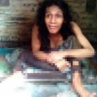 12-tahun-hidup-pasungan-keluarga-keberatan-agus-dibawa-ke-rsj