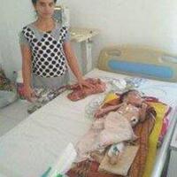 bocah-gizi-buruk-berusia-18-tahun-asal-subulussalam-meninggal-dunia