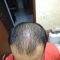 reborn-help-rambut-gua-rontok-hampir-botak