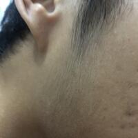 group-brewok-quotbrengozerquot-forum-resmi-berbagi-informasi-progress-hair-facial---part-1