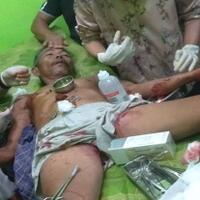 duel-dengan-buaya-pencari-ikan-lolos-dari-maut