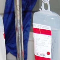 simak--begini-gejala-awal-penyakit-cacar-monyet-yang-menyerang-tubuh-manusia