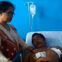 diterkam-buaya-dada-dan-pinggang-pria-ini-terluka