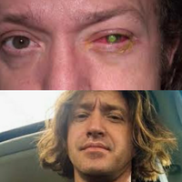 kasus-tragis-akibat-kebiasaan-sehari-hari