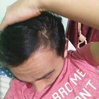 reborn-help-rambut-gua-rontok-hampir-botak