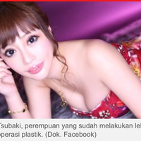 operasi-plastik-hingga-300-kali-perempuan-jepang-habiskan-rp-4-miliar