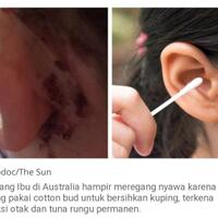 viralnya-cutton-bud-menjadi-penyebab-infeksi-otak