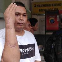 2-begal-kambuhan-di-medan-ditembak-mati-sering-tebas-tangan-korbannya