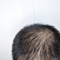 reborn-help-rambut-gua-rontok-hampir-botak