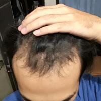 reborn-help-rambut-gua-rontok-hampir-botak