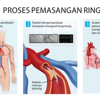 mengenal-perkembangan-teknologi-di-bidang-kesehatan-indonesia-selama-6-bulan-terakhir