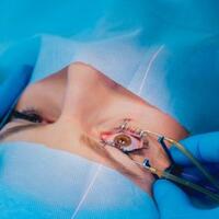 bisakah-transplantasi-kornea-babi-diadopsi-di-indonesia-ini-pendapat-mui