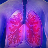 5-tips-simpel-ini-bisa-menyelamatkan-mu-dari-penyakit-paru-paru