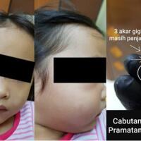 nyawa-bocah-ini-hampir-melayang-gara-gara-giginya-berlubang