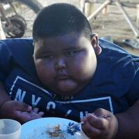 satia-bocah-7-tahun-berbobot-101-kg-asal-karawang-meninggal-dunia