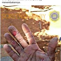 unggahan-foto-telapak-tangan-melepuh-terkena-gas-air-mata-ini-penjelasannya