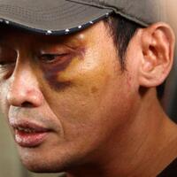 ninoy-sebut-habib-ingin-buang-mayatnya-di-kerusuhan