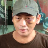 ninoy-karundeng-diculik-dihajar-diinterogasi-dengan-kata-kata-mengerikan