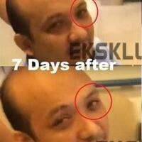 viral-video--mata-baik-baik-saja--novel-baswedan-ungkap-cerita-sebenarnya