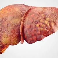 hepatitis-a-dprd-kota-depok--pemkot-tidak-becus