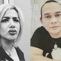 ngeri-bibir-jontor-barbie-kumalasari-ternyata-gara-gara-kena-santet