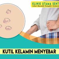 apakah-kutil-kelamin-menyebar