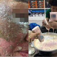 hati-hati-gaes-wajah-wanita-ini-hancur-gara-gara-pakai-skincare-palsu