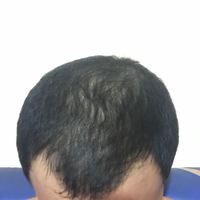 reborn-help-rambut-gua-rontok-hampir-botak