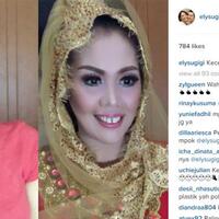 elly-sugigi-lakukan-potong-gigi-hasilnya-bikin-geleng-geleng
