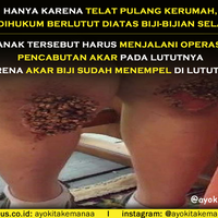 dihukum-berlutut-di-atas-biji-bijian-selama-9-jam-lutut-anak-ini-menjadi-seperti-ini