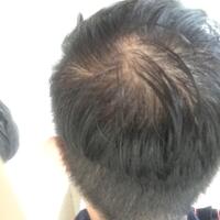 post-image