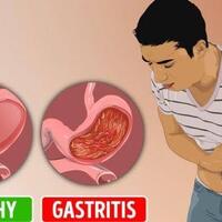 sakit-perut-bagian-kanan-atas-hati-hati-bisa-jadi-itu-gastritis