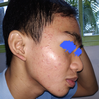 post-image