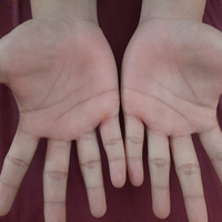 baca-garis-tangan---gratis