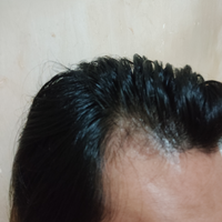 reborn-help-rambut-gua-rontok-hampir-botak