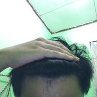 reborn-help-rambut-gua-rontok-hampir-botak