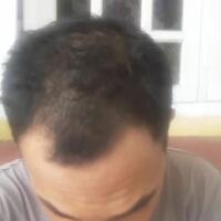 reborn-help-rambut-gua-rontok-hampir-botak