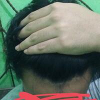 reborn-help-rambut-gua-rontok-hampir-botak