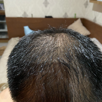 reborn-help-rambut-gua-rontok-hampir-botak---part-1