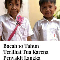 cutis-laxa-penyakit-langka-satu-di-antara-sepuluh-juta-jiwa