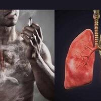 5-benda-di-dapur-ini-bisa-bersihkan-paru-paru-perokok-berat-sehat-lagi