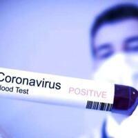 gak-nyangka-ternyata-begini-gaya-hidup-sehari-hari-pasien-corona-asal-depok