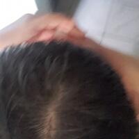 reborn-help-rambut-gua-rontok-hampir-botak---part-1