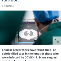 ini-dia-kisah-nyata-mantan-positif-covid-19-di-indonesia